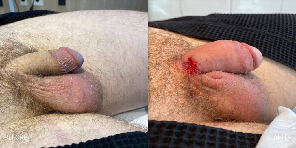 Patient before and after