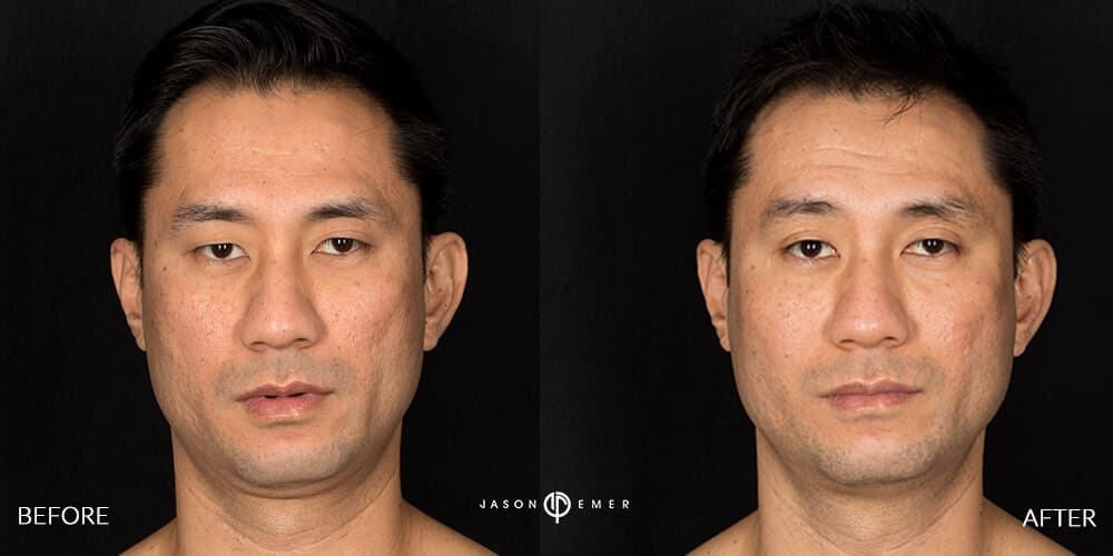 Patient before and after