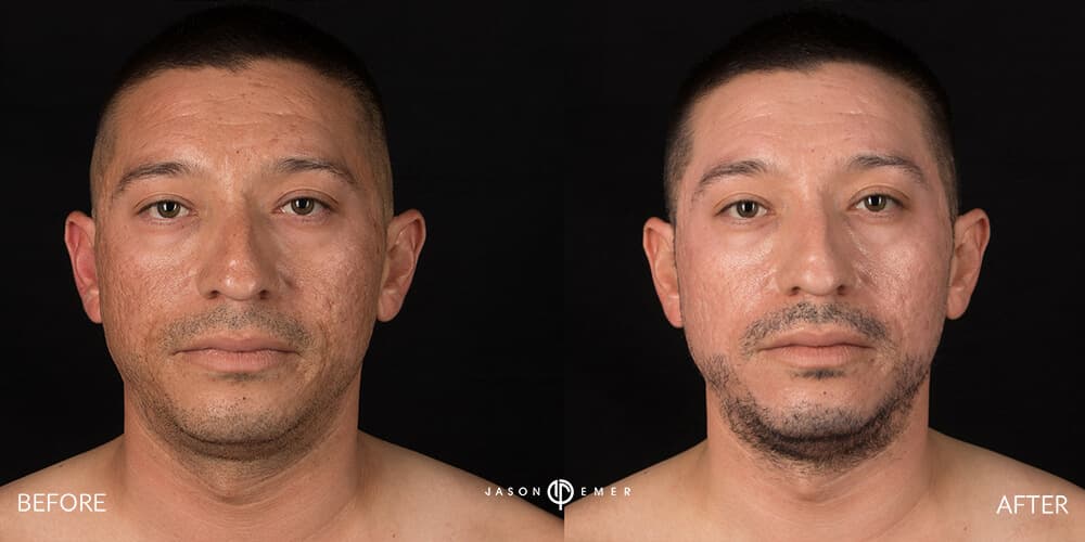 Patient before and after