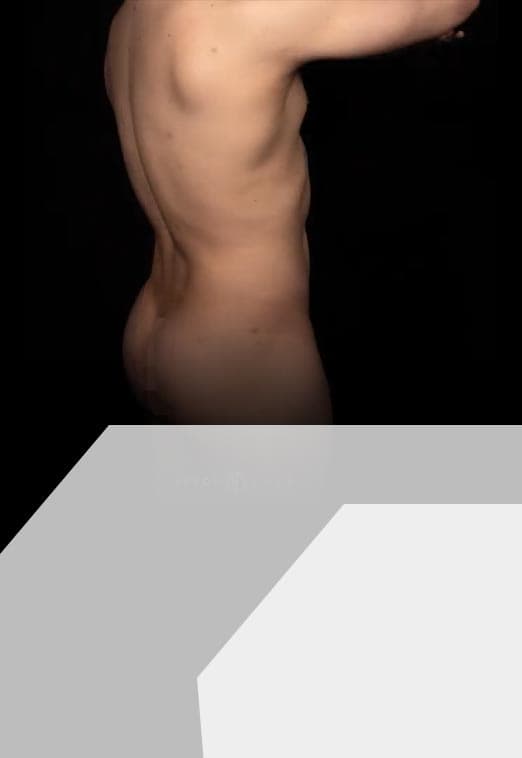 Nick's Story