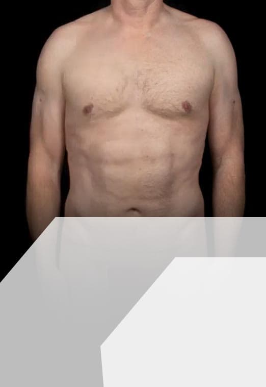 Chris's Story