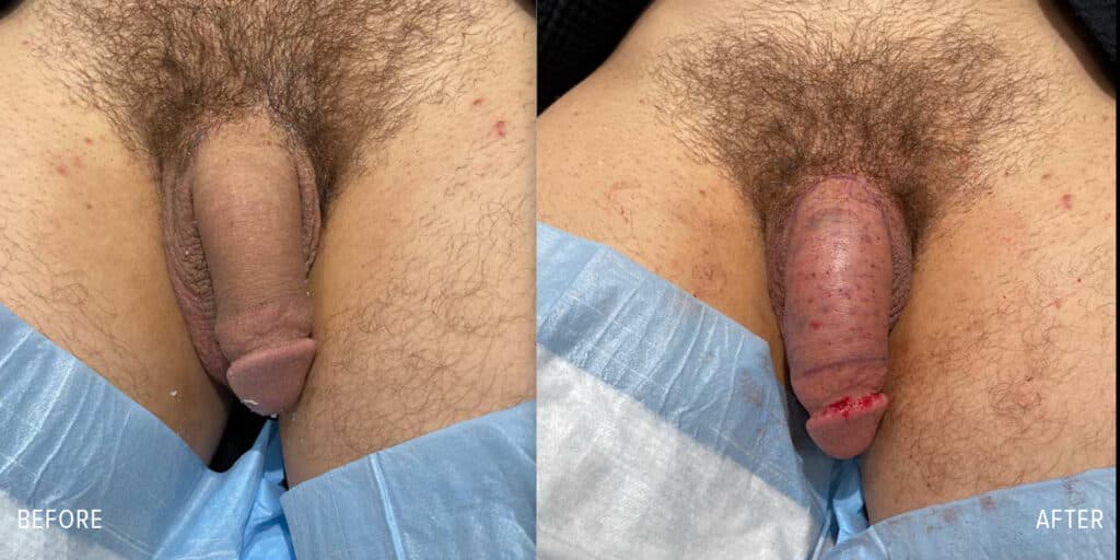 Patient before and after