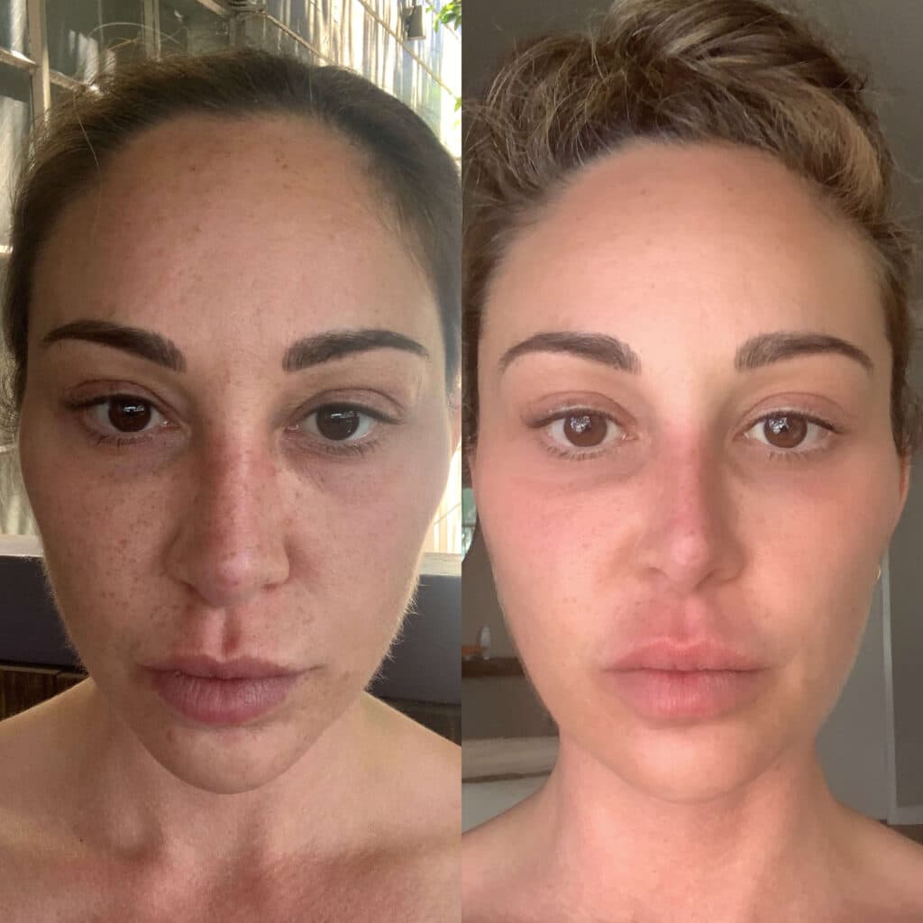 Patient before and after