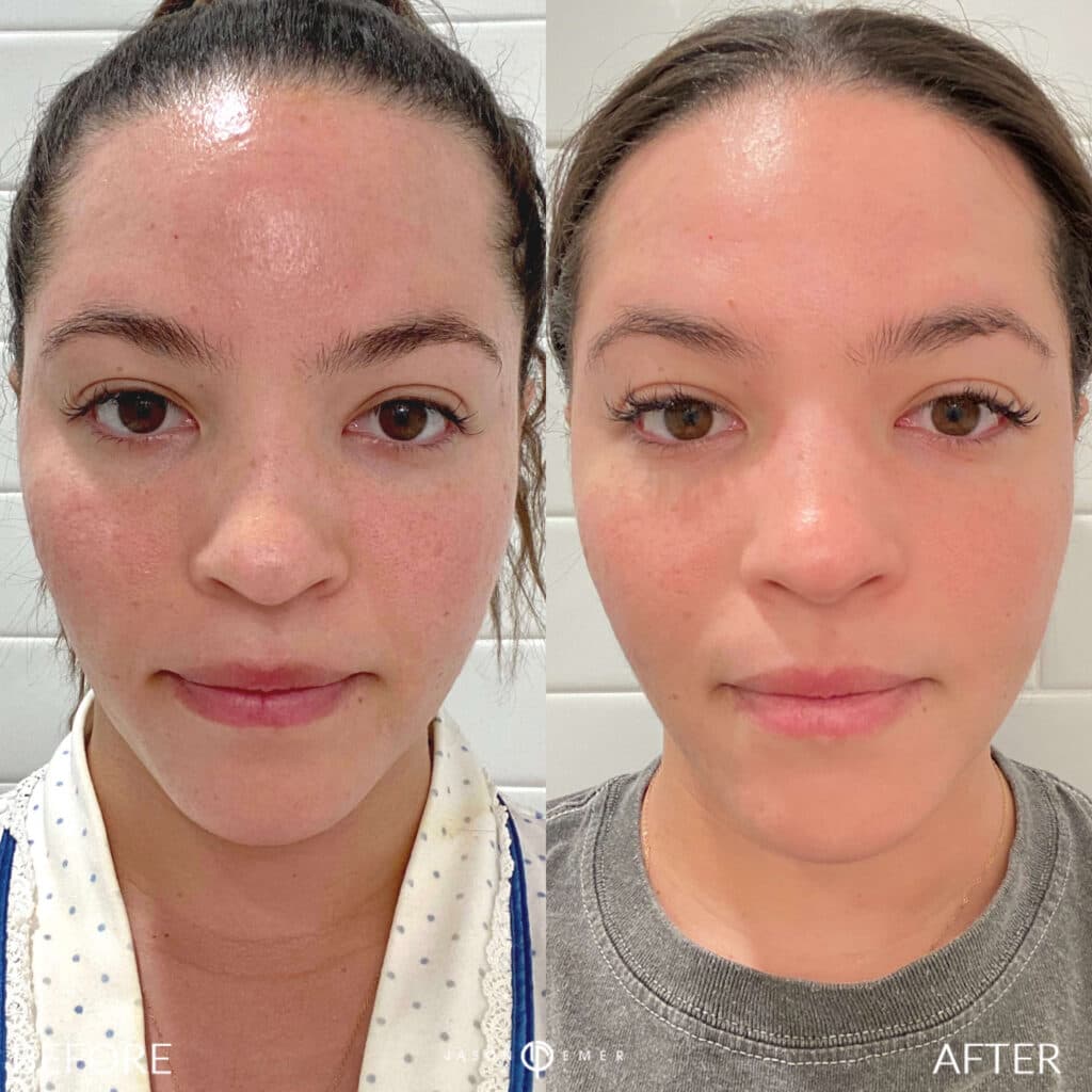 Patient before and after