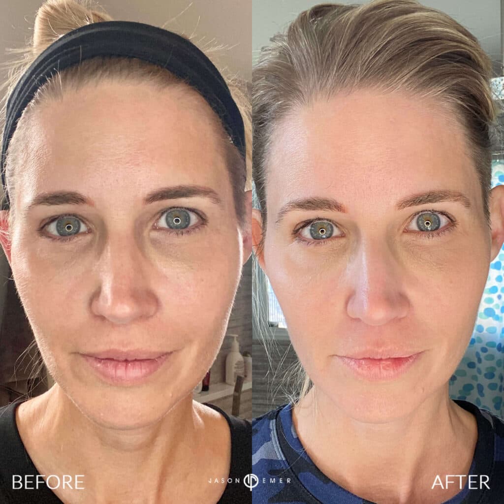 Patient before and after