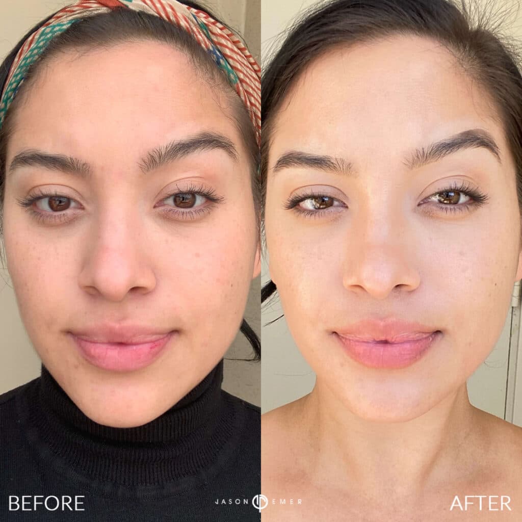 Patient before and after