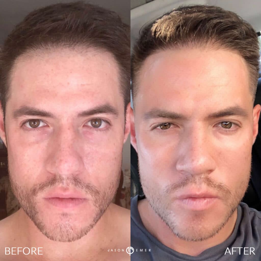 Patient before and after