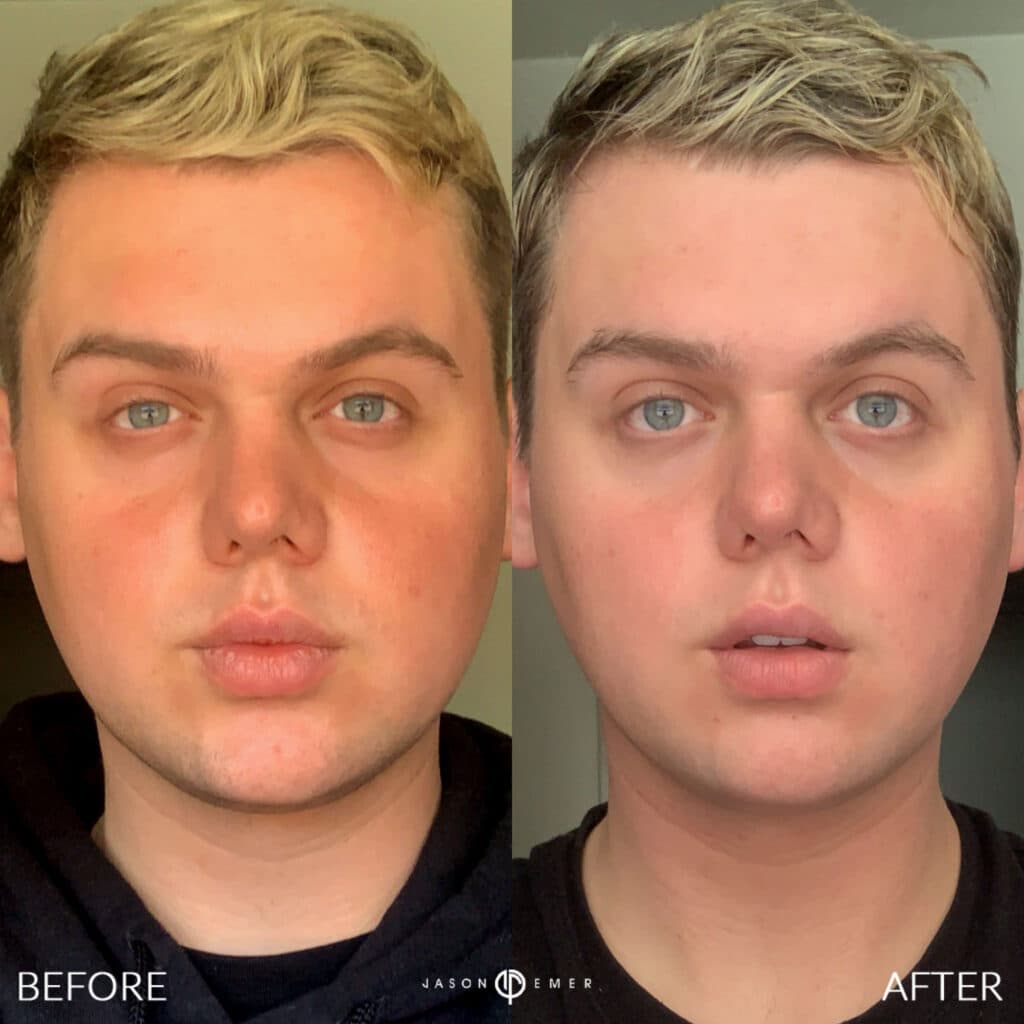 Patient before and after