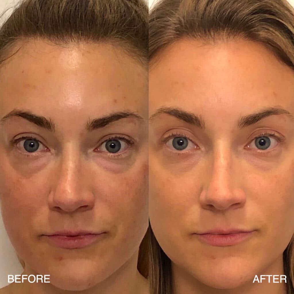Patient before and after