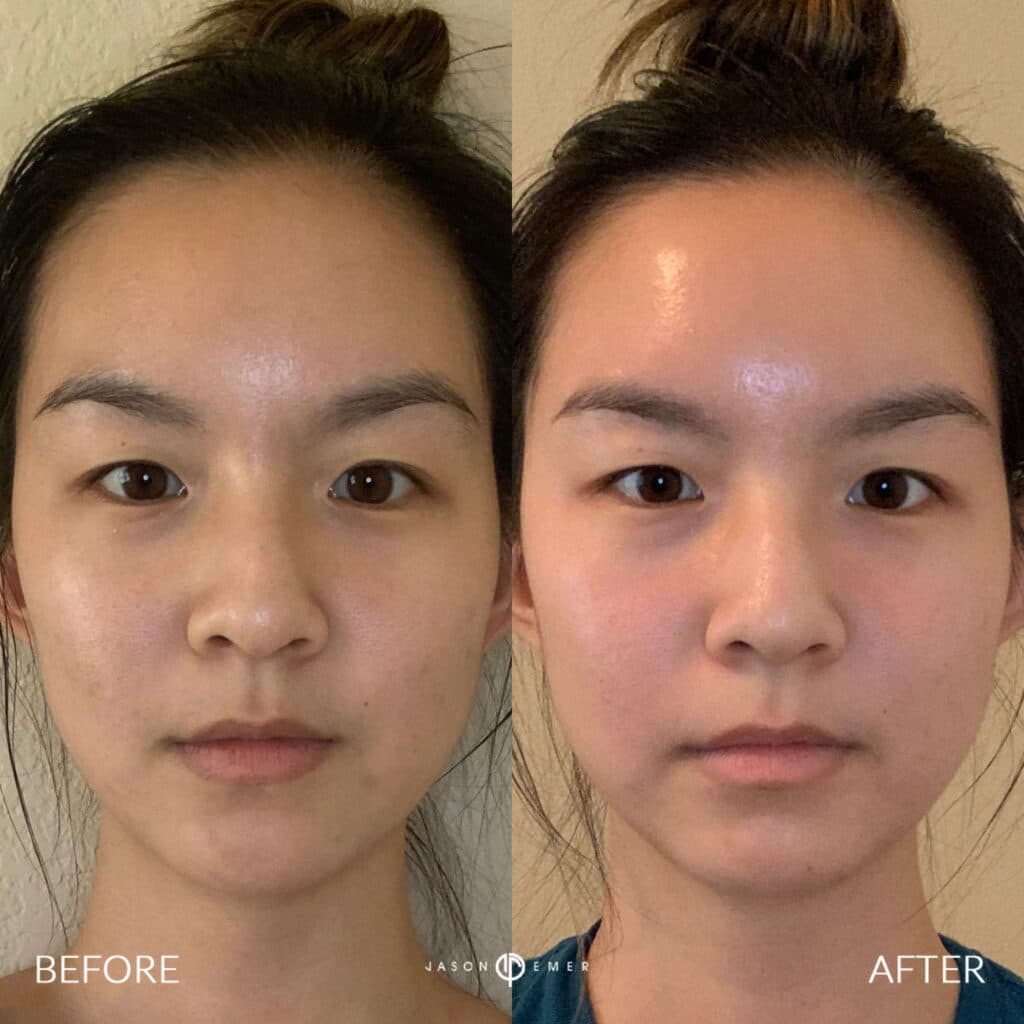 Patient before and after