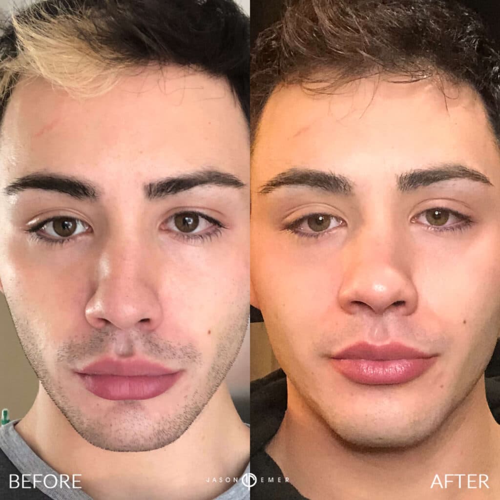 Patient before and after
