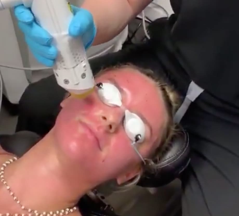 PORE TREATMENT