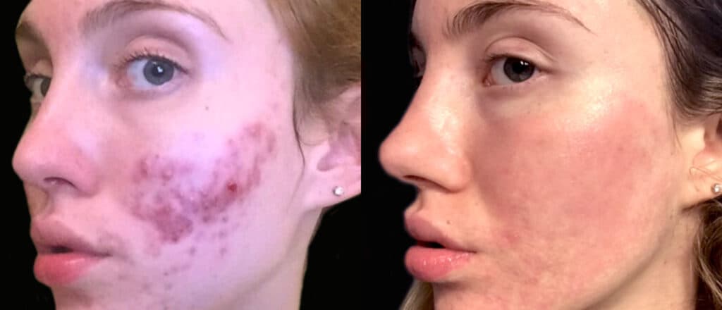 Patient before and after