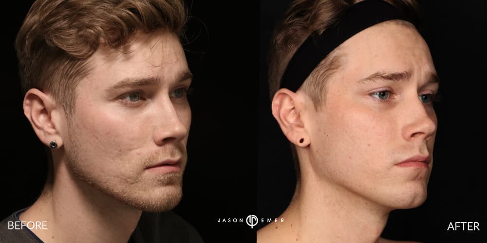 colton2