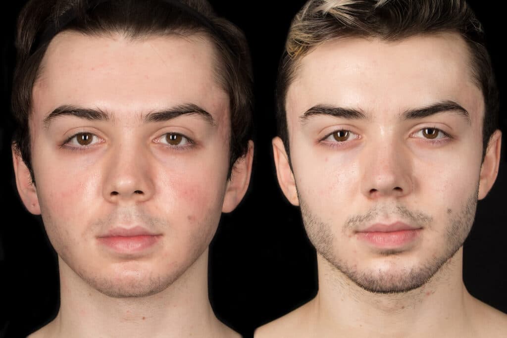 Patient before and after