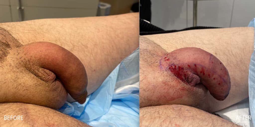Patient before and after