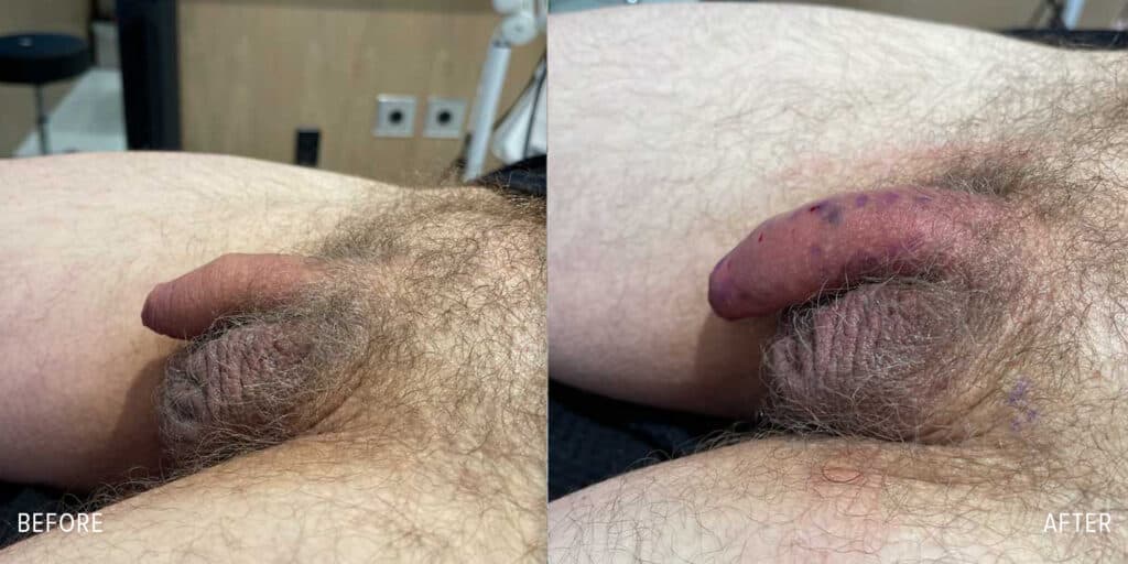Patient before and after