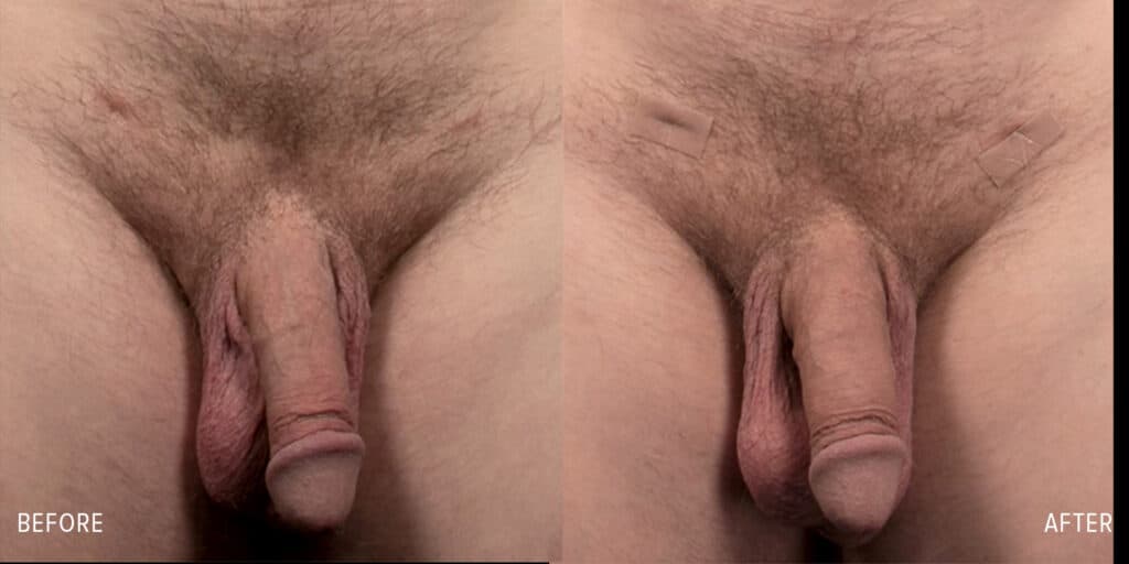 Patient before and after