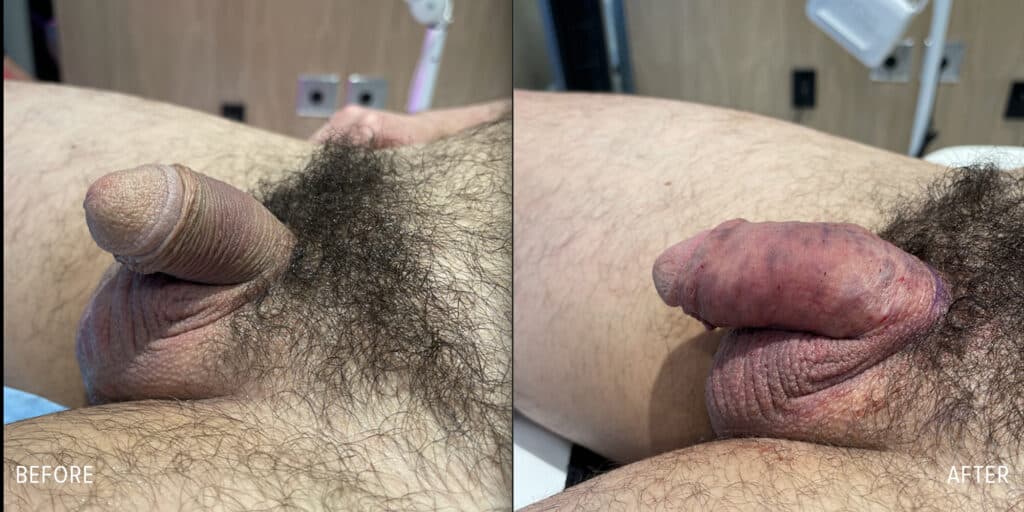 Patient before and after