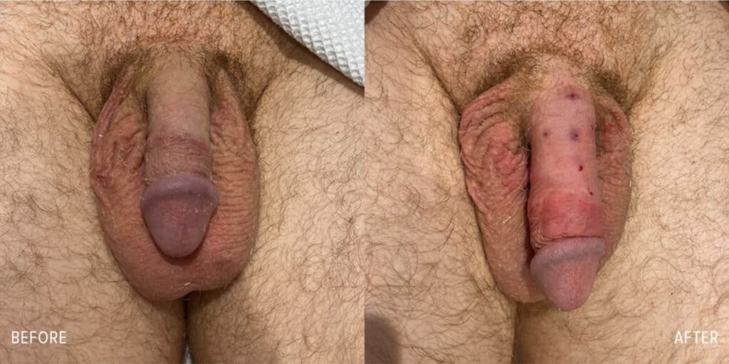 Patient before and after