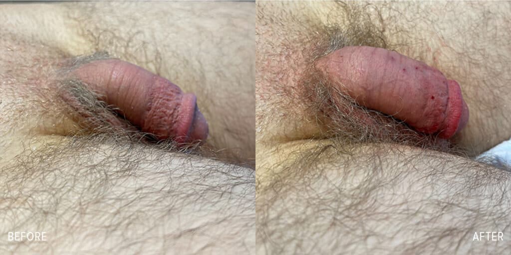 Patient before and after