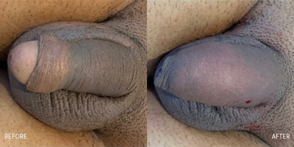 Patient before and after