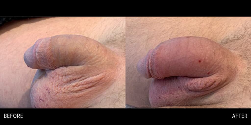 Patient before and after