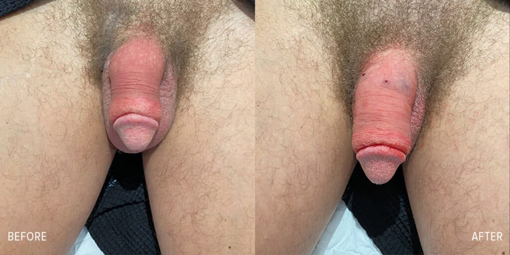 Patient before and after