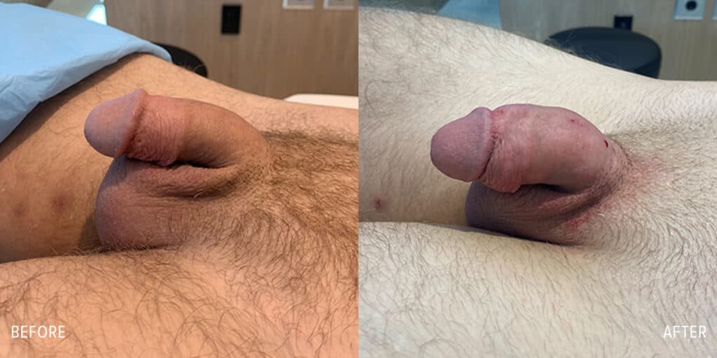 Patient before and after