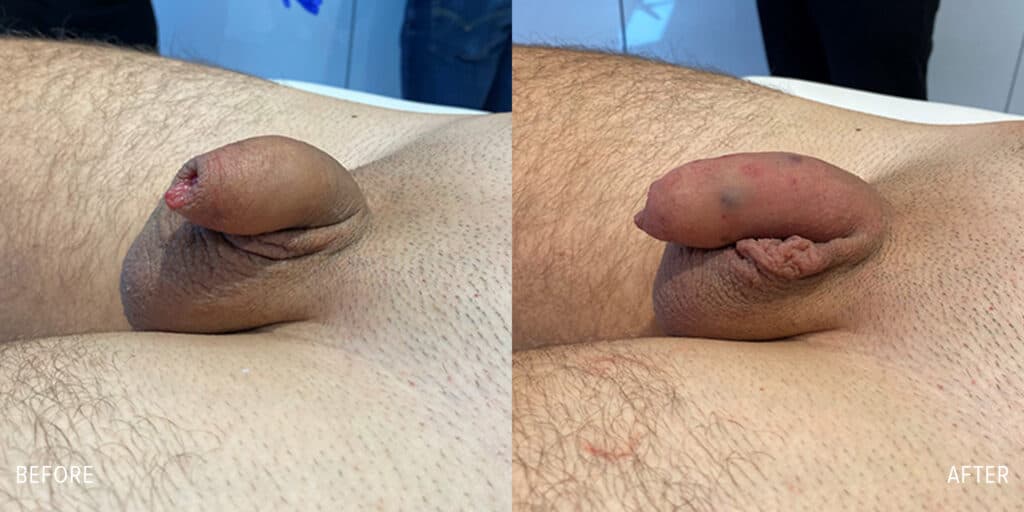 Patient before and after