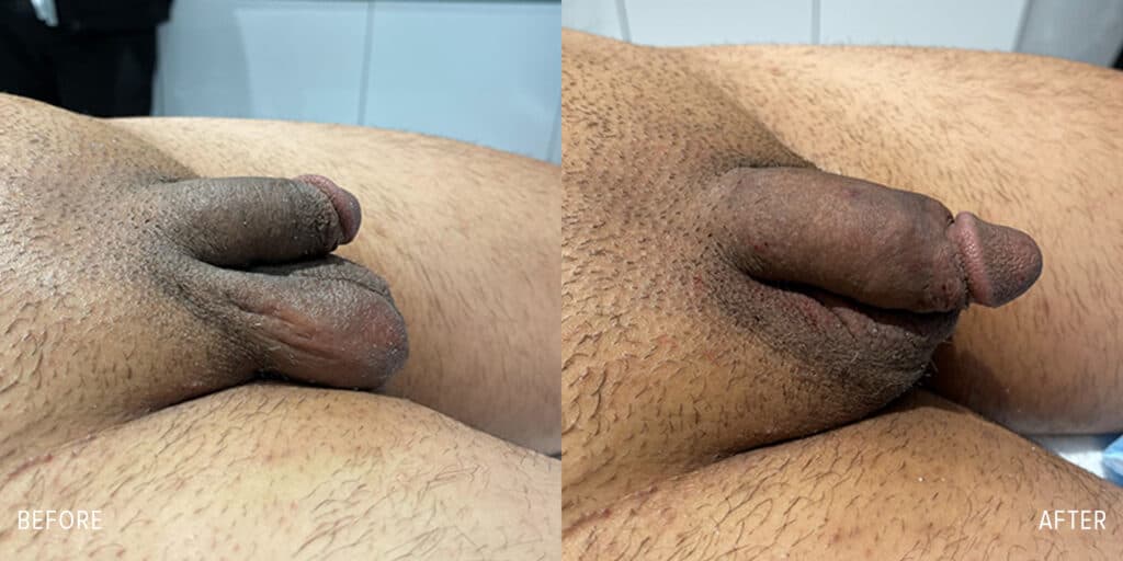 Patient before and after