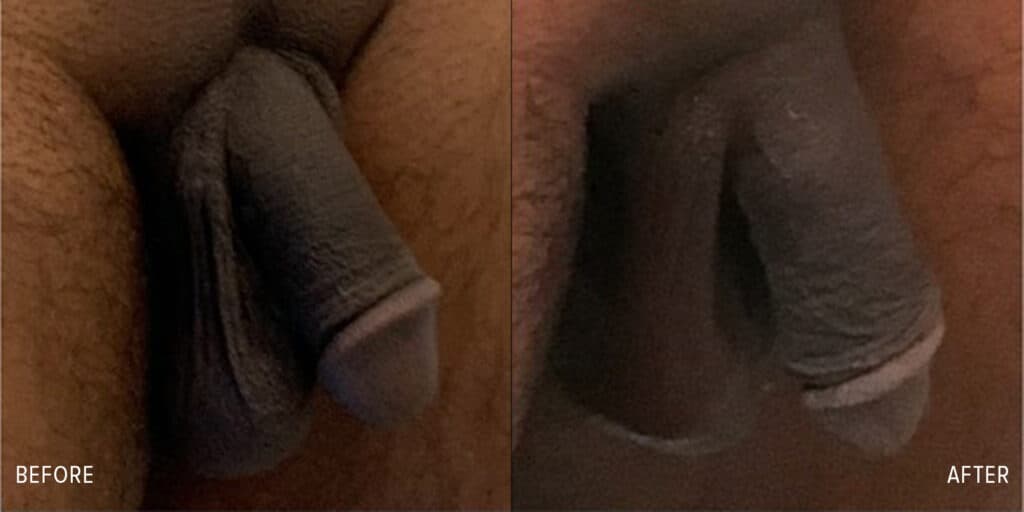 Patient before and after