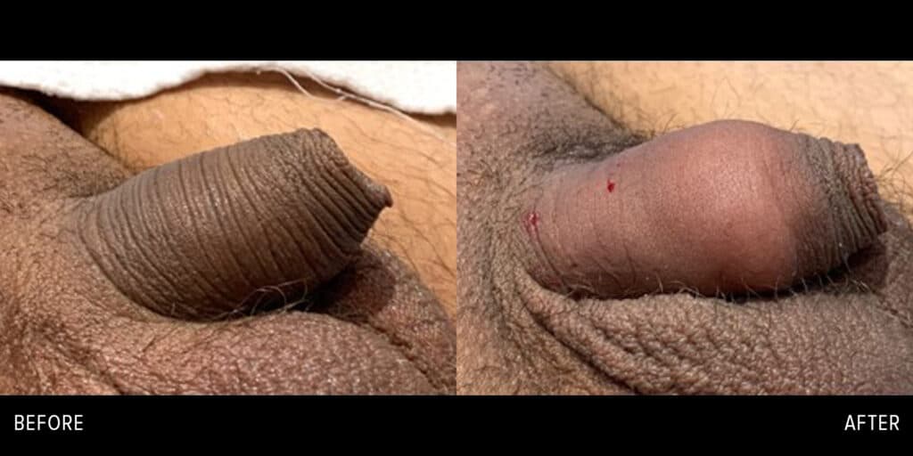 Patient before and after