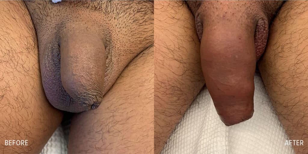 Patient before and after