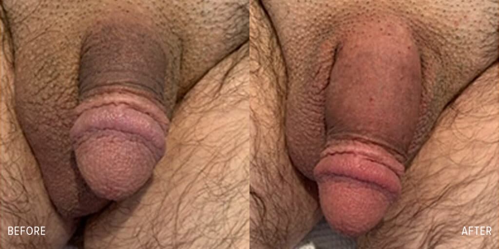 Patient before and after