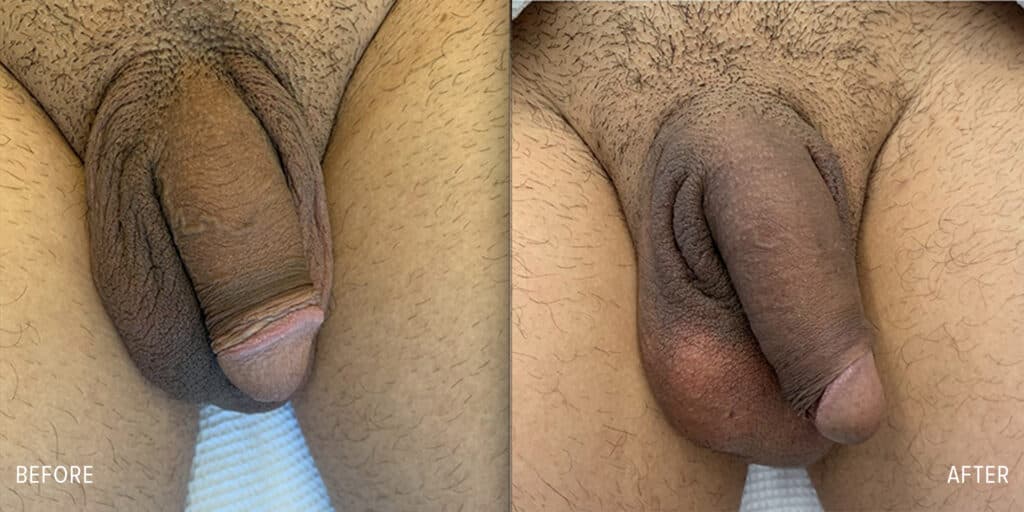 Patient before and after