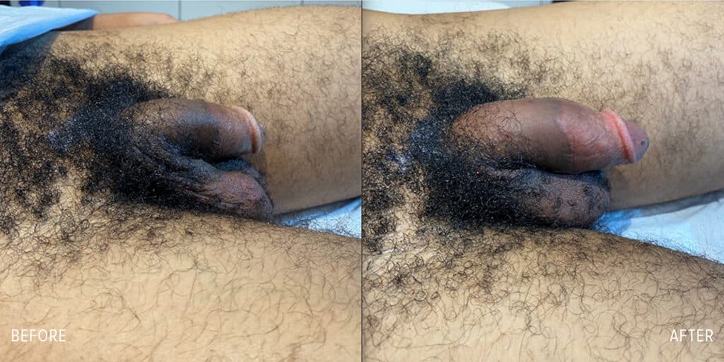 Patient before and after