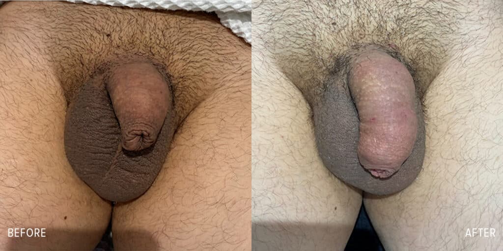 Patient before and after