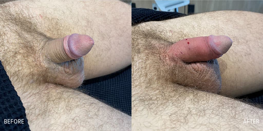 Patient before and after
