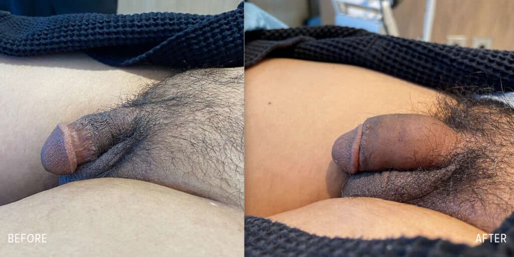 Patient before and after