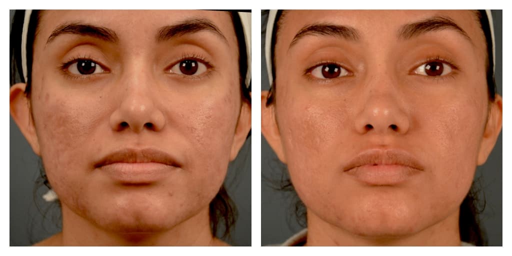 Patient before and after