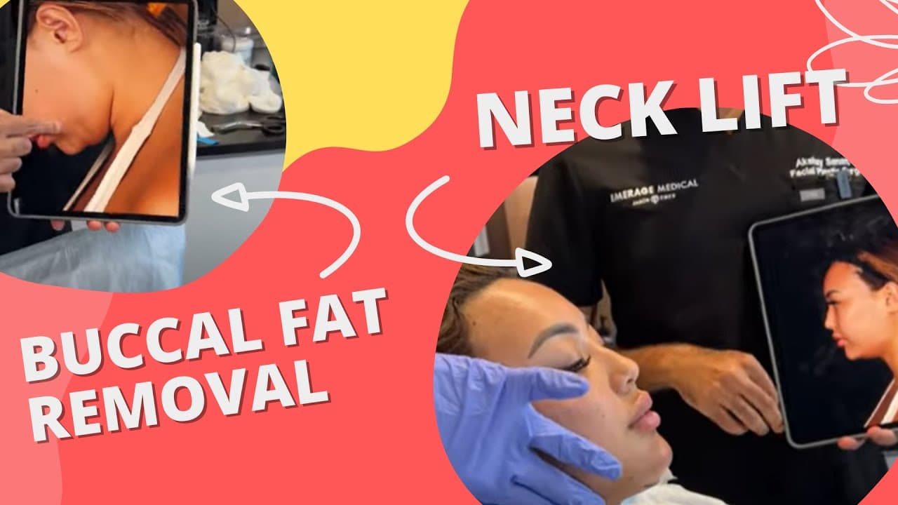 Watch a buccal fat pad removal procedure video