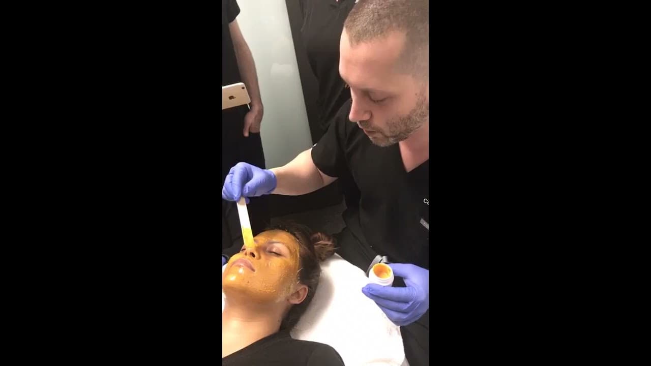 Watch a melasma procedure video