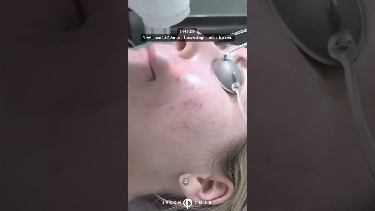 Watch a abdominal lipo for women lp procedure video