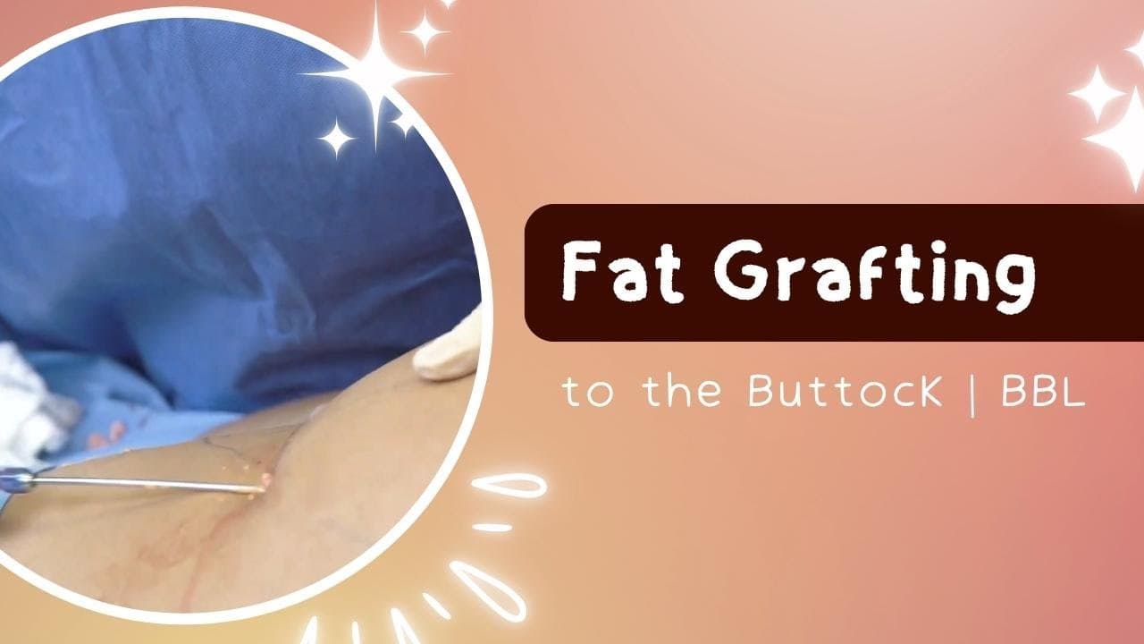 Watch a plastic surgery brazilian butt lift procedure video