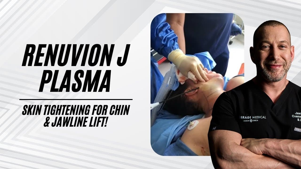 Watch a face and neck liposuction procedure video