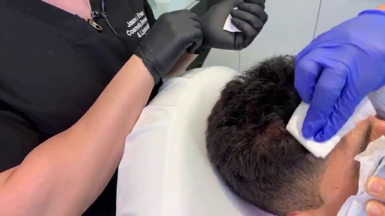 Watch a regenerative medicine & stem cell therapy procedure video