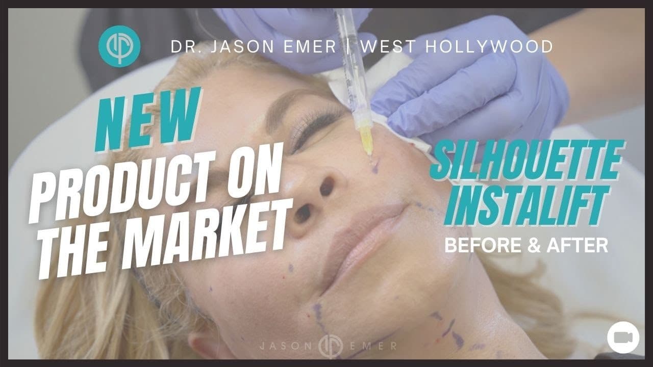Watch a facelift procedure video