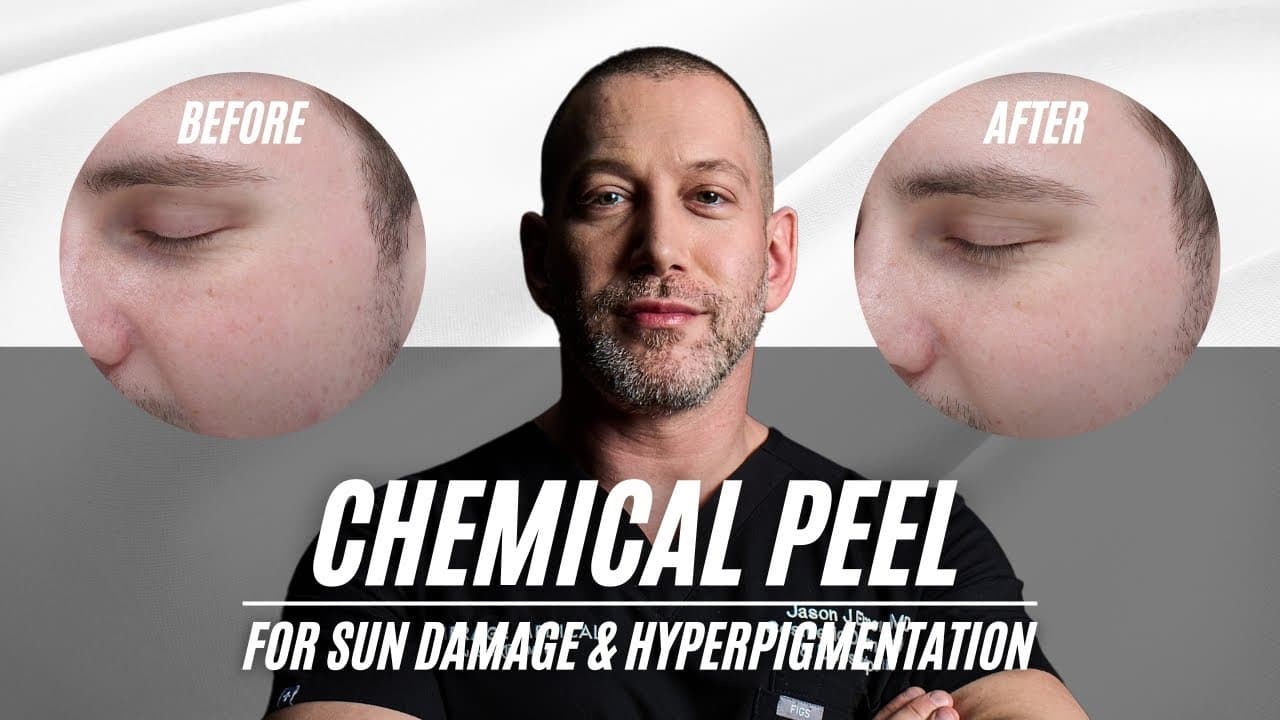 Watch a saltfacial procedure video