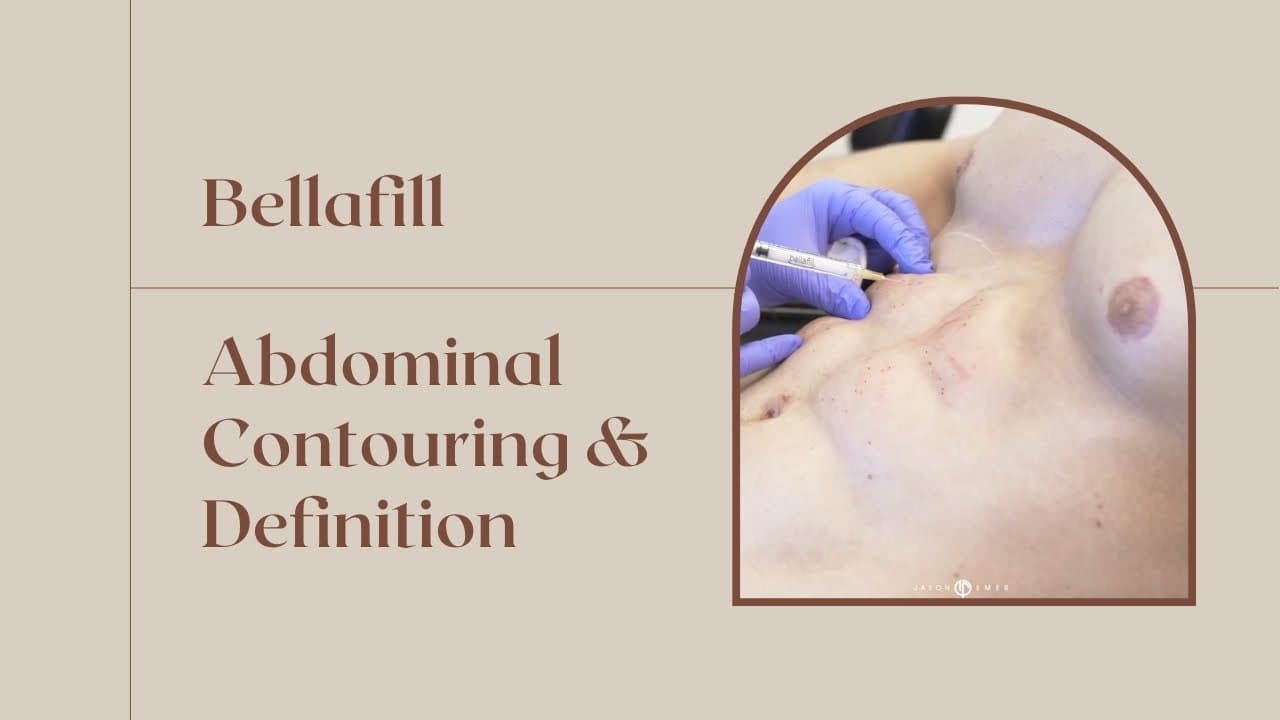 Watch a abdominal lipo for men lp procedure video